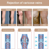 Womens 20-30 mmHg Compression Pantyhose Tights Varicose Veins Stockings Leg Slimming Hip Up